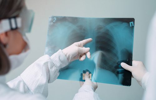 normal chest x-ray