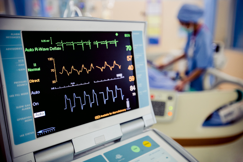 What Is An EKG And Why Do I Need One?