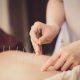 using acupuncture for back pain